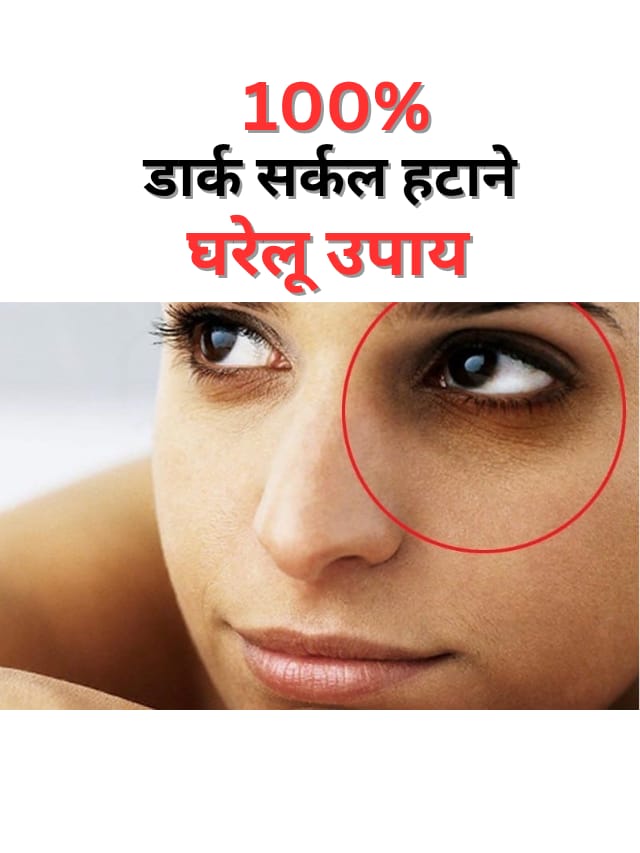 डार्क सर्कल.